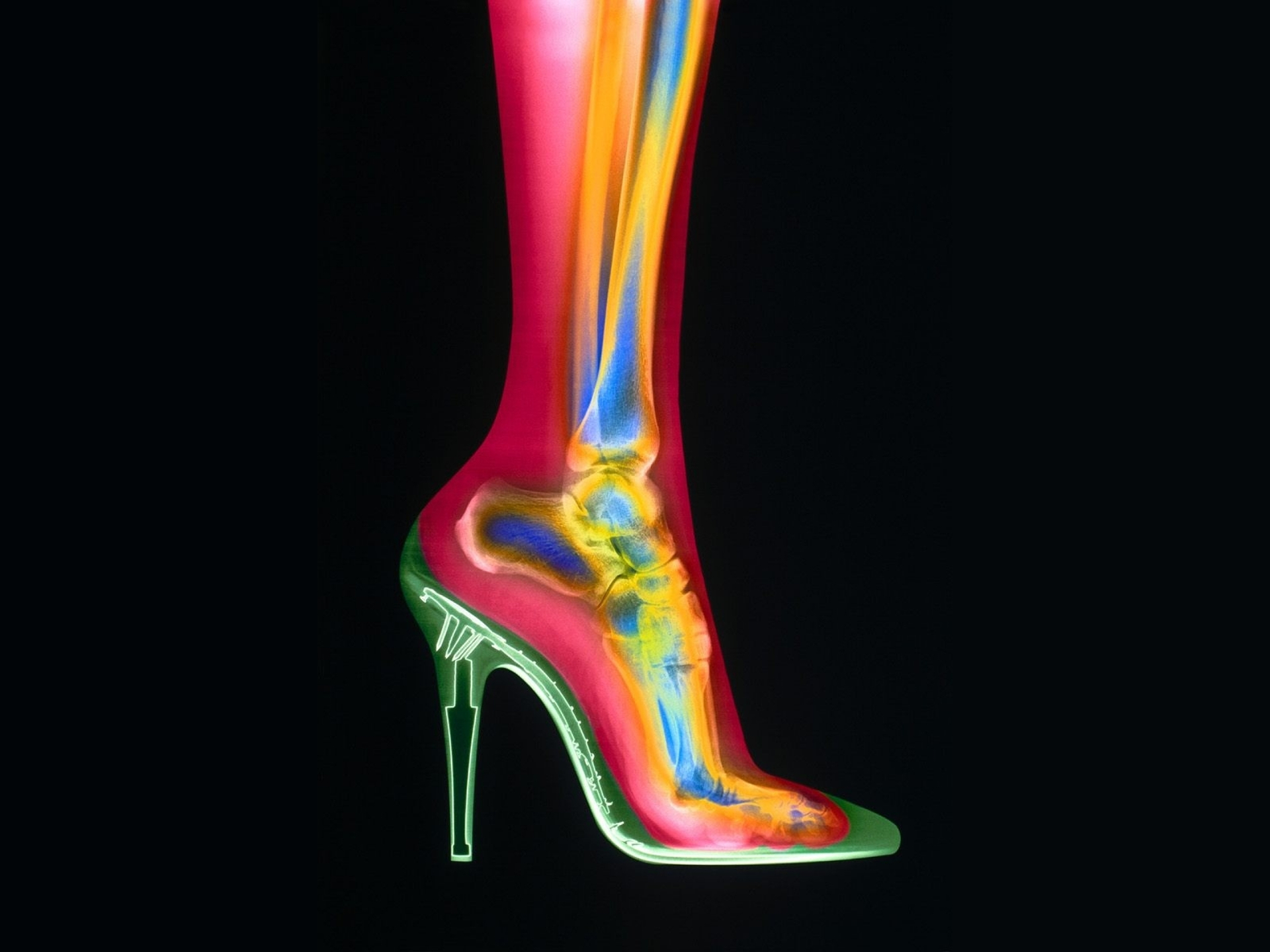 X-ray high heel shoe photography with a leg visible.