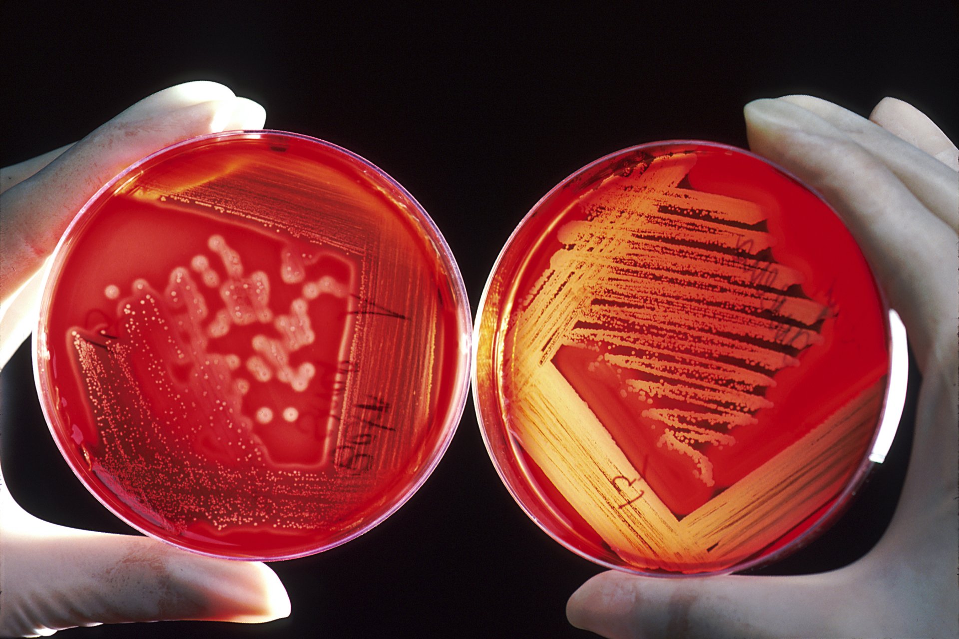 Close-up laboratory view of two red agar plates held by gloved hands, bacterial streaks visible — technology and science 2K Quad HD PC desktop wallpaper/background.